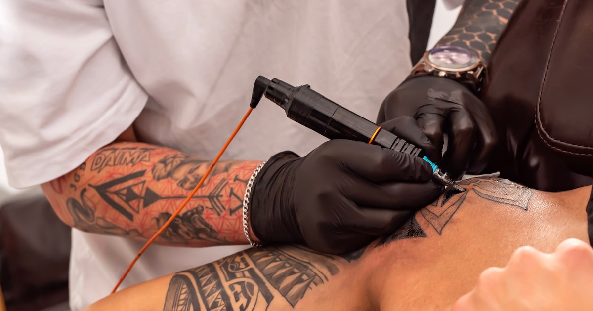 Je tattoo weglaseren lijkt simpel, maar er zijn risico's: 'Het leek alsof ik een gat in mijn arm had